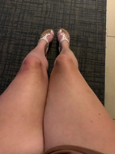 I SEE WOMEN, MEN, COUPLES . FETISH FRIENDLY - Photo 3 | Escort in 290